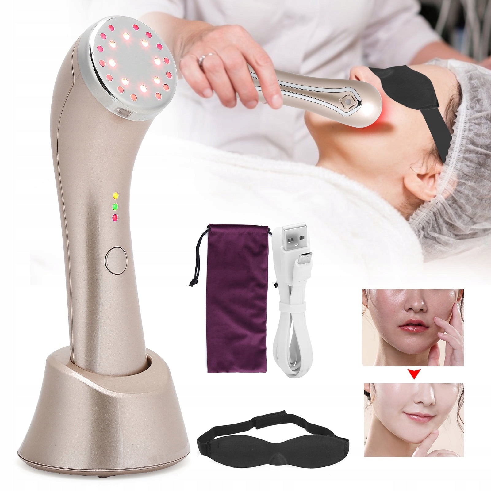 3-IN-1 MESOTHERAPY LIGHT THERAPY LIFTING