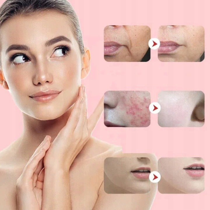 7in1 Face Massager Needleless Electric Mesotherapy EMS Lifting LED Medical device no
