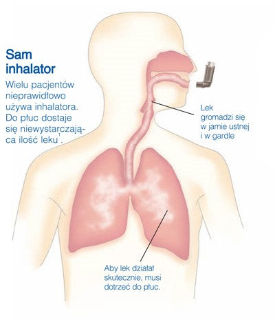 AeroChamber Plus Flow-Vu for infants - inhaler Medical device yes