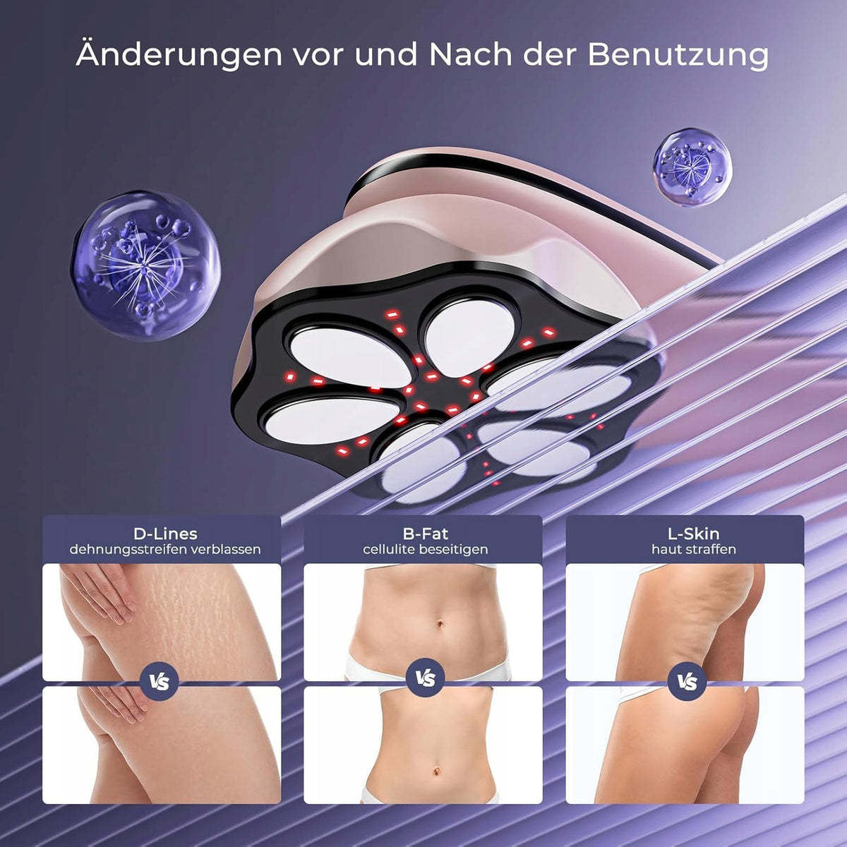 Anti-cellulite massager with 6 massage heads for abdomen, waist, shoulders Packaging status original