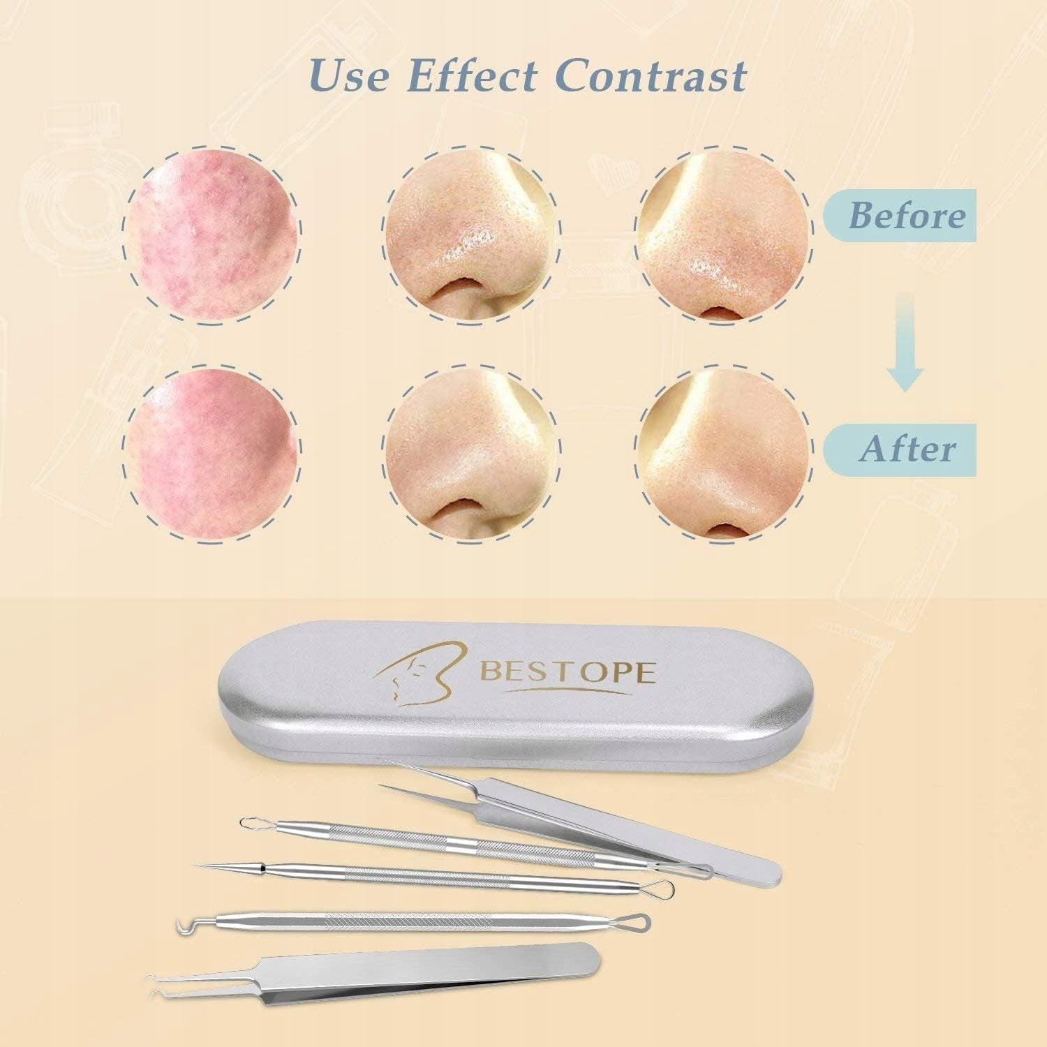 BESTOPE PRO 6-Piece Blackhead Removal Kit Stainless Steel Handle Brand Bestope