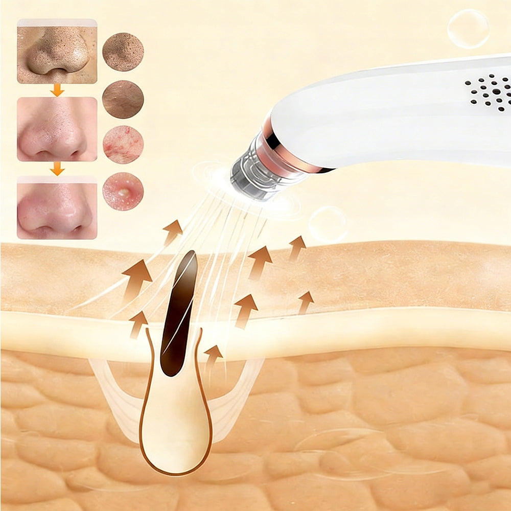 BLACKHEAD PORE VACUUM CLEANER 6 SUCTION TIPS 3 LEVELS OF USB POWER Manufacturer code Odkurzacz Do Wągrów JHF-09