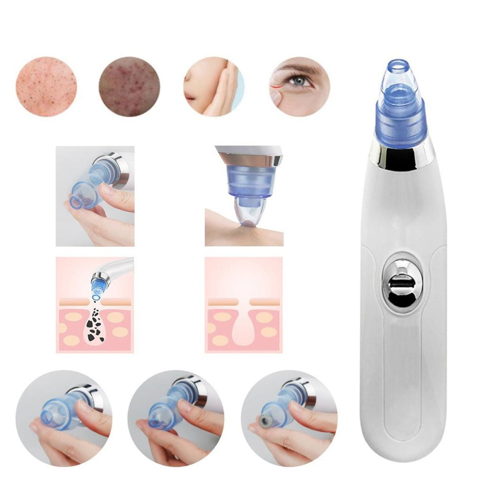 BLACKHEAD VACUUM CLEANER MICRODERMABRASION KUGO HOME Packaging status original