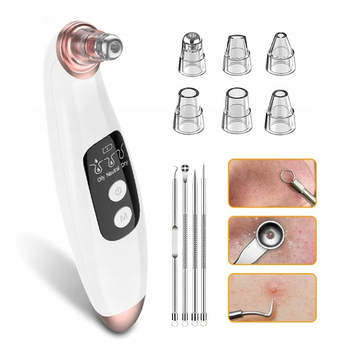 BLACKHEAD VACUUM CLEANER PORE FACE CLEANSING DEVICE USB Medical device no