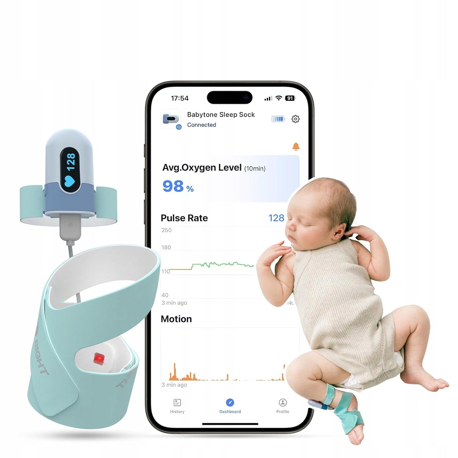 Baby Breathing Sleep Monitor Children 0-3 Years, Alarm, Application, Results