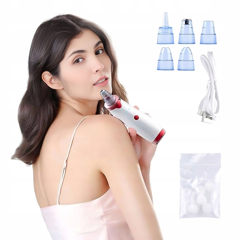 Blackhead vacuum cleaner pore pimple home care usb Batteries included no