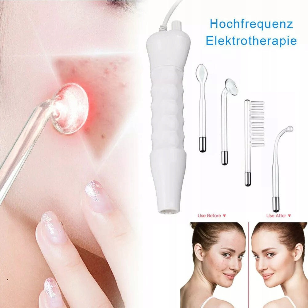 COSMETIC DEVICE MICROCURRENTS OZONE DERMA CURRENTS White 5PCS