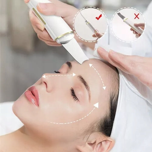Cavitation Peeling Face Ultrasonic Blackhead Removal Batteries included yes
