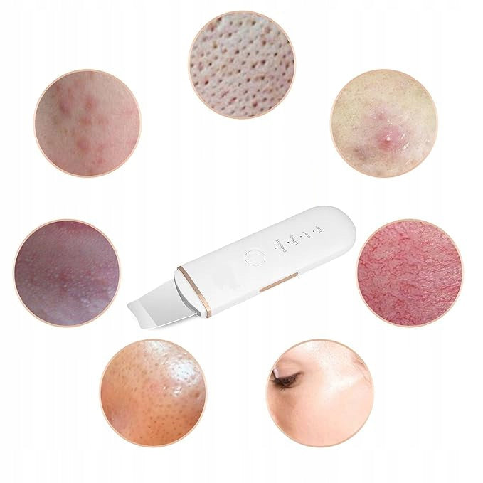 Cavitation Peeling Face Ultrasonic Blackhead Removal Brand no brand