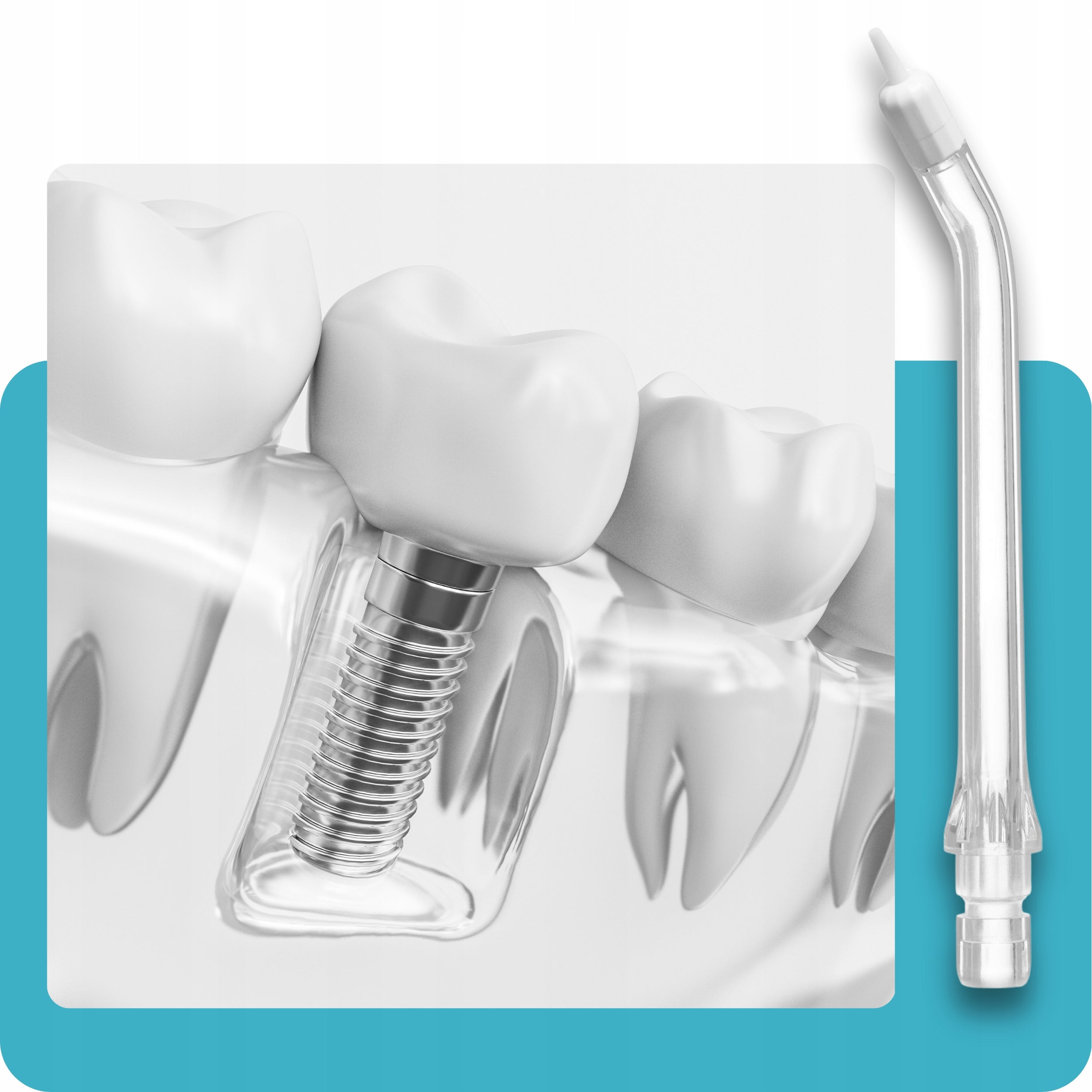Dental Oral Irrigator Wireless DentalForce 310ml Power supply rechargeable battery