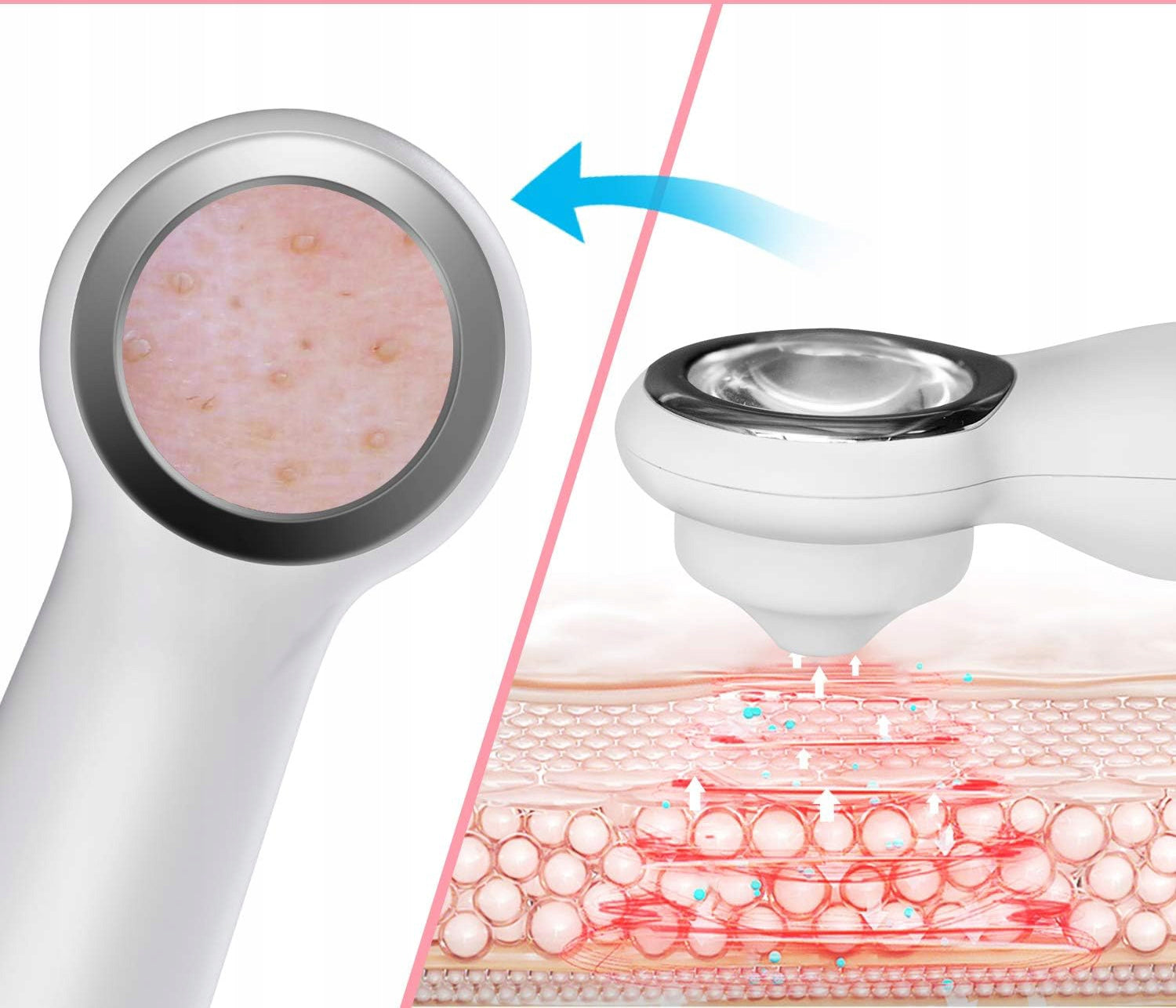 Device for suctioning blackheads Romanda Packaging status original