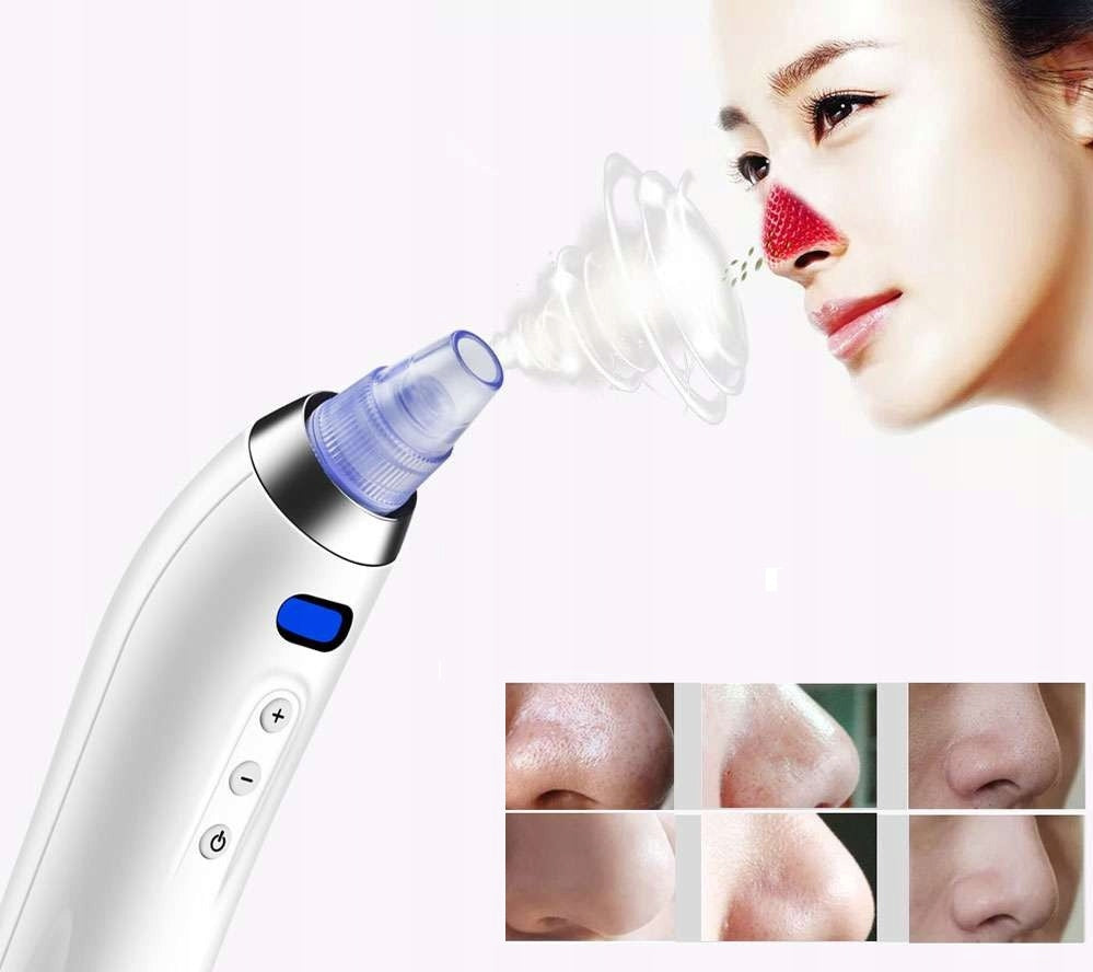 ELECTRIC BLACKHEAD REMOVAL VACUUM CLEANER FACIAL PORE PURIFIER Brand no brand