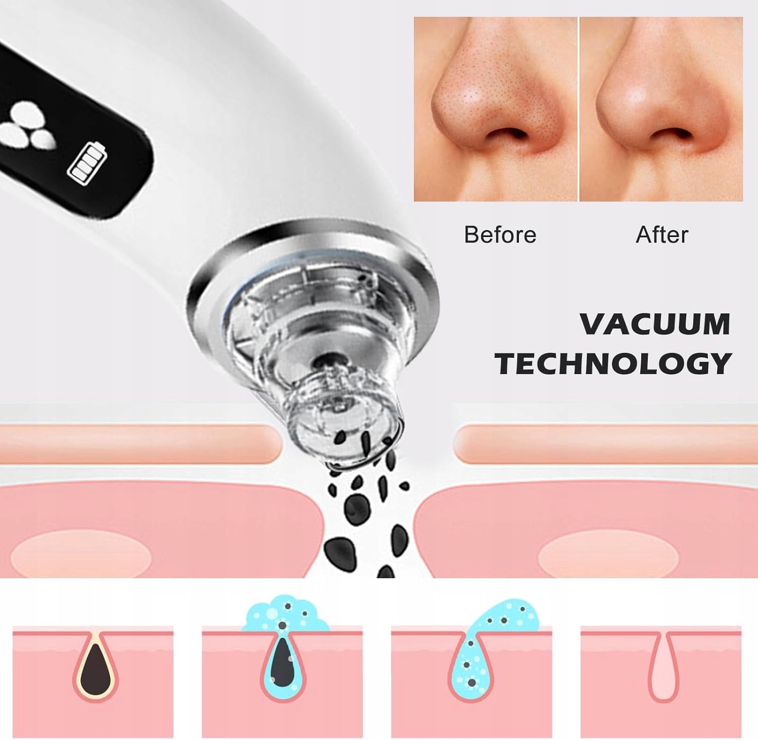 FACIAL PORE PURIFIER WITH 6 BLACKHEAD TIPS AND 4 SUCTION DEGREES