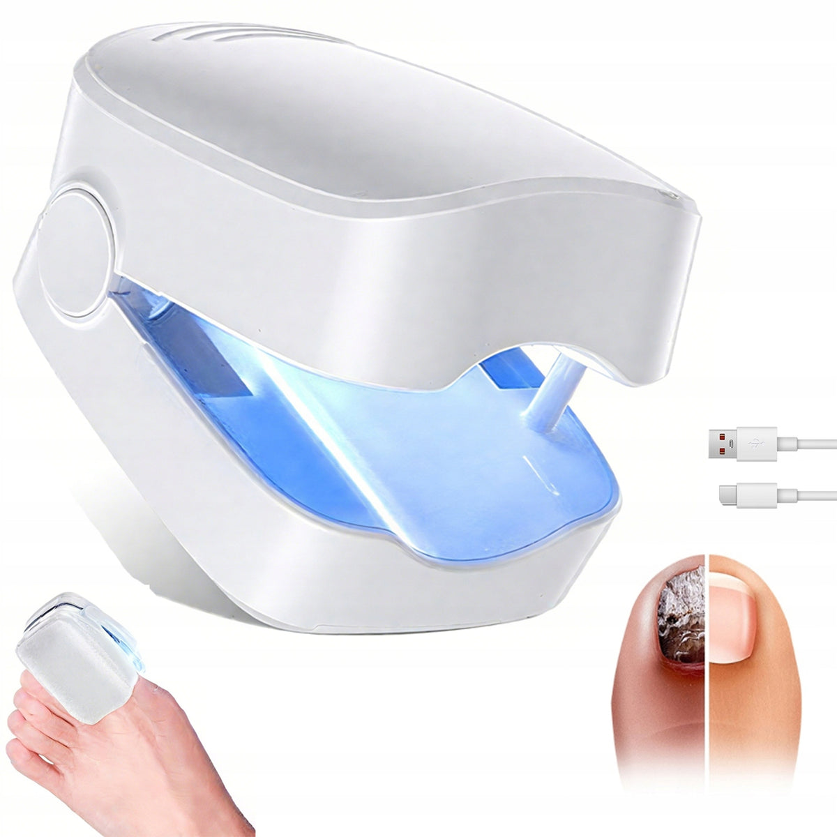 LASER FOR NAIL FUNGUS 407NM WITHOUT DRUGS HOME TREATMENT