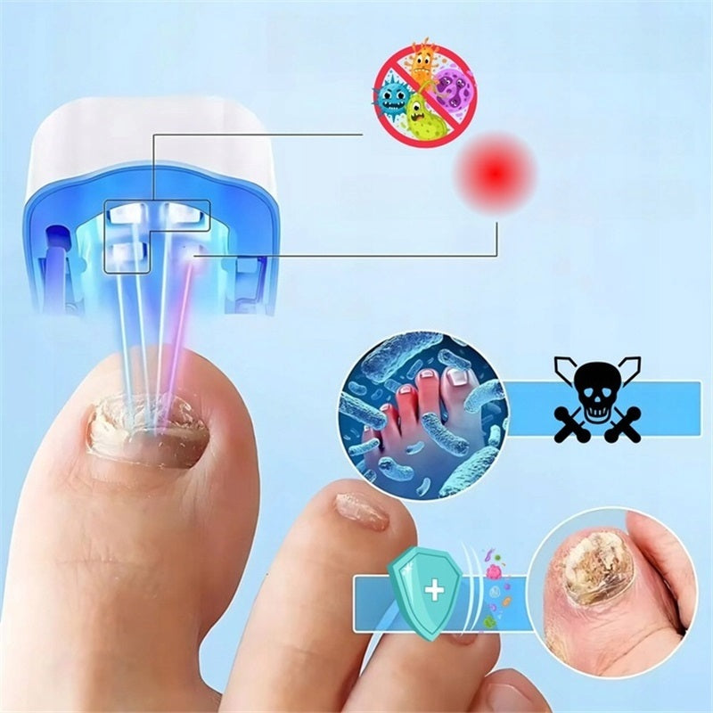 LASER NAIL FUNGUS TREATMENT DEVICE PAINLESS EFFECTIVE Packaging status original