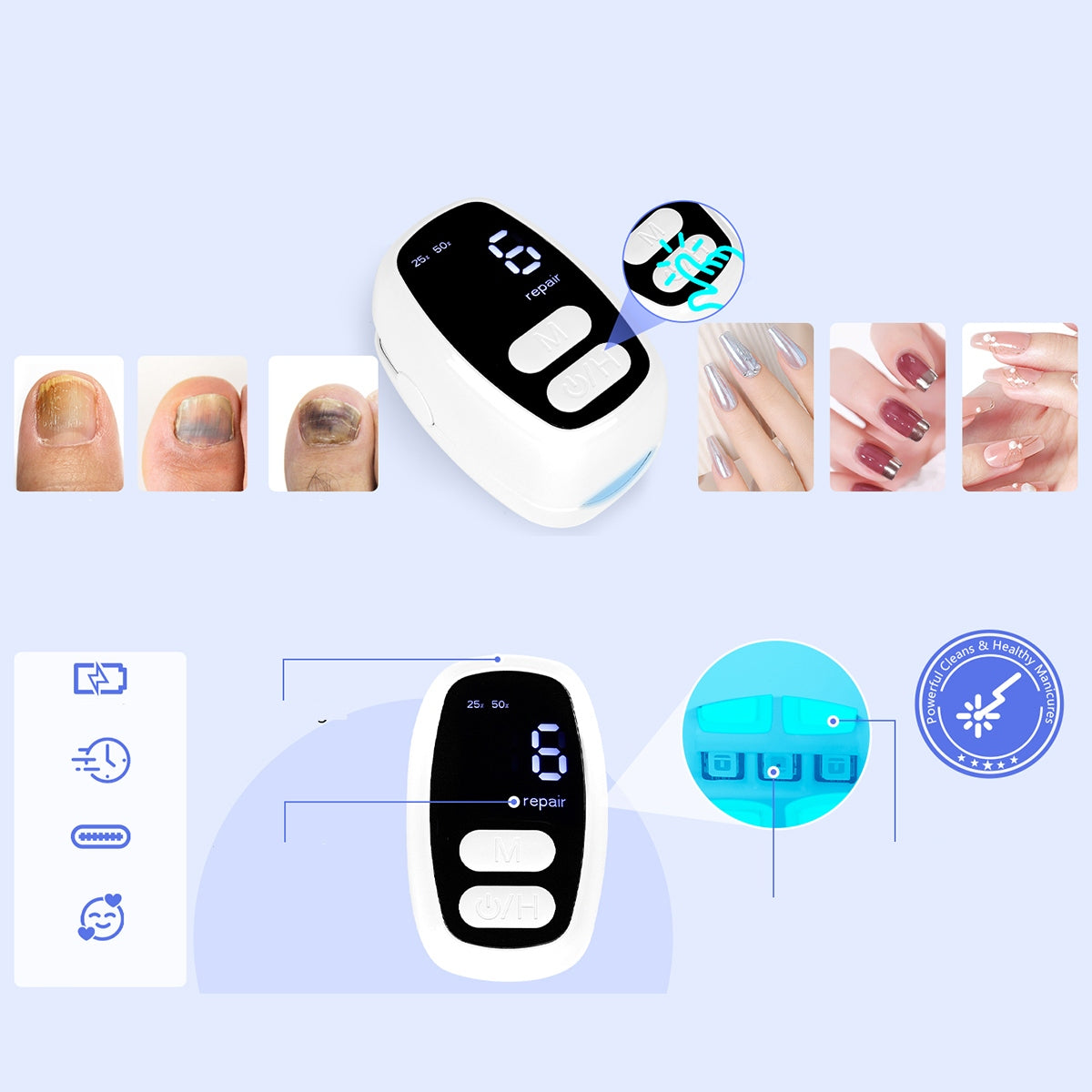 Laser device for the treatment of ringworm | Hands and Feet Medical device no