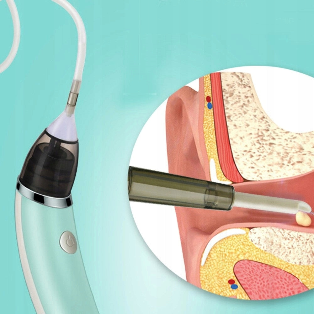 MULTIFUNCTIONAL ELECTRIC NASAL ASPIRATOR QATAR VACUUM CLEANER FOR KIDS Packaging status original
