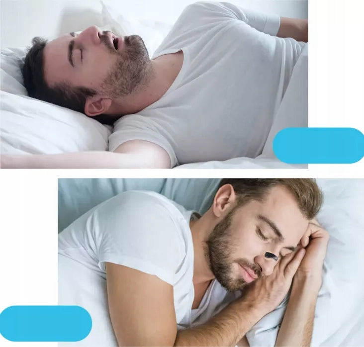 Magnetic Nasal Dilator Patches Against Snoring 30 Days Medical device no