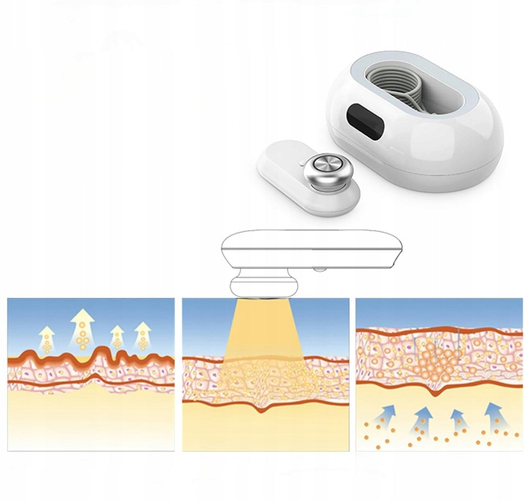 RF ViQure Radio Frequency Skin Rejuvenation Device Manufacturer code B0BFFM6T65