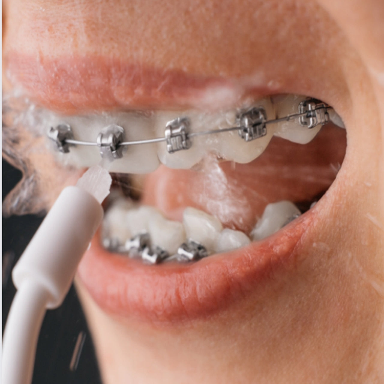 SMILEY WIRELESS DENTAL TOOTH IRRIGATION 4 TIPS + freebie Model Pro Aqua