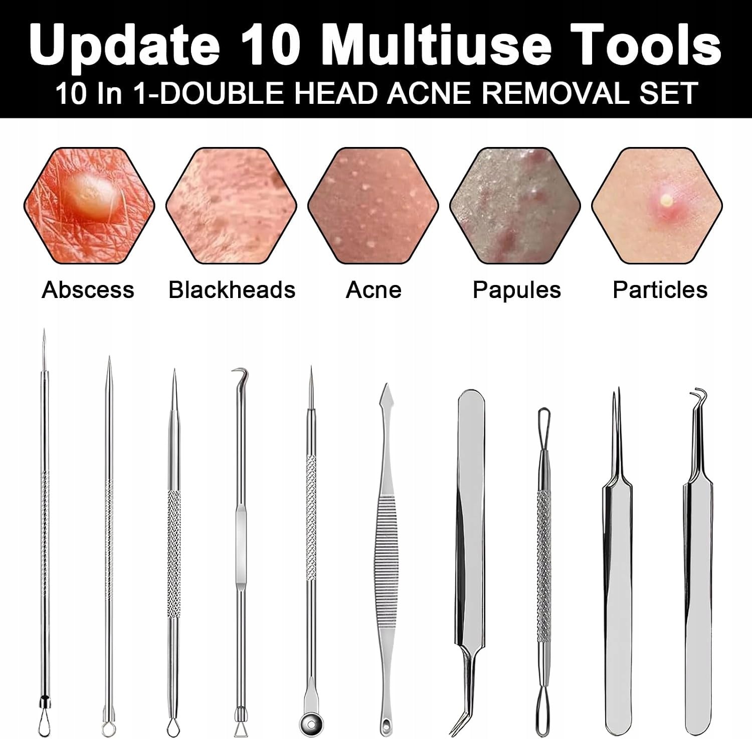 Set of 10 tools for squeezing pimples and blackheads, for removing blackheads, Brand no brand