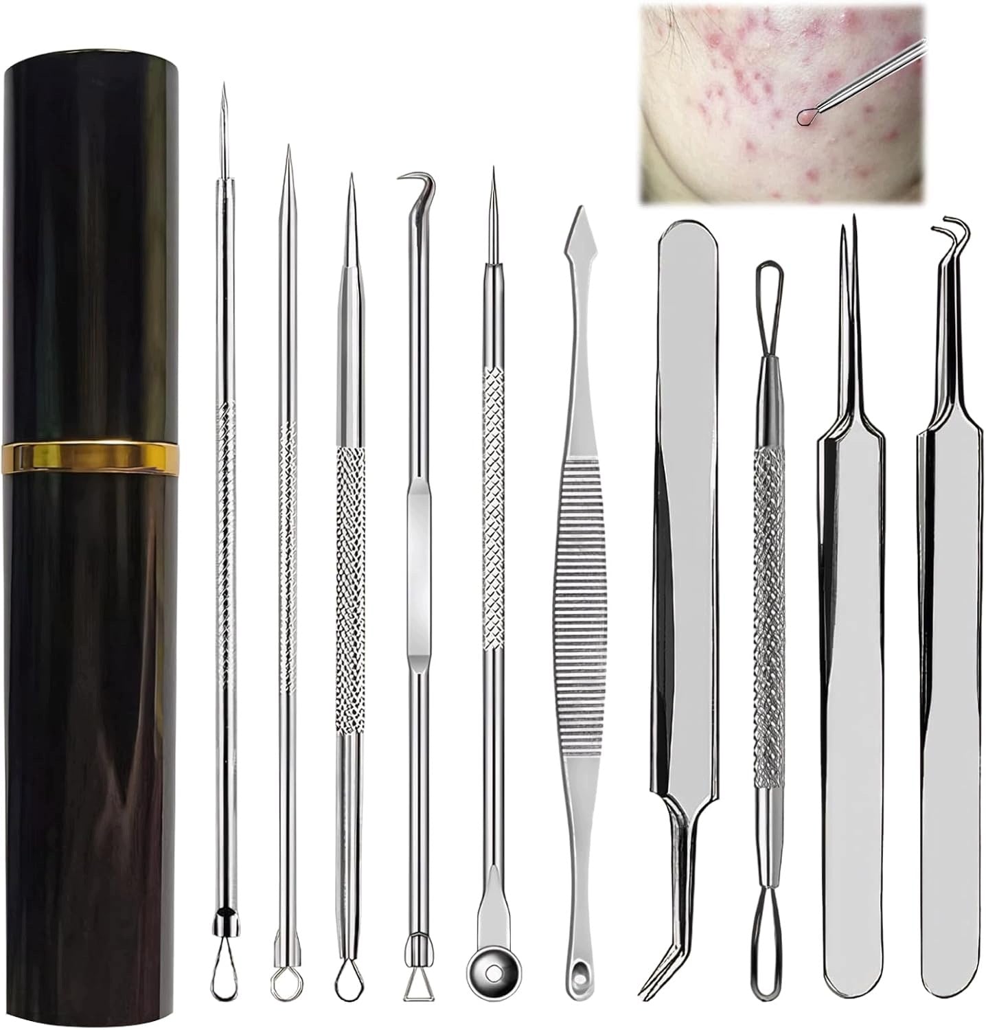 Set of 10 tools for squeezing pimples and blackheads, for removing blackheads,