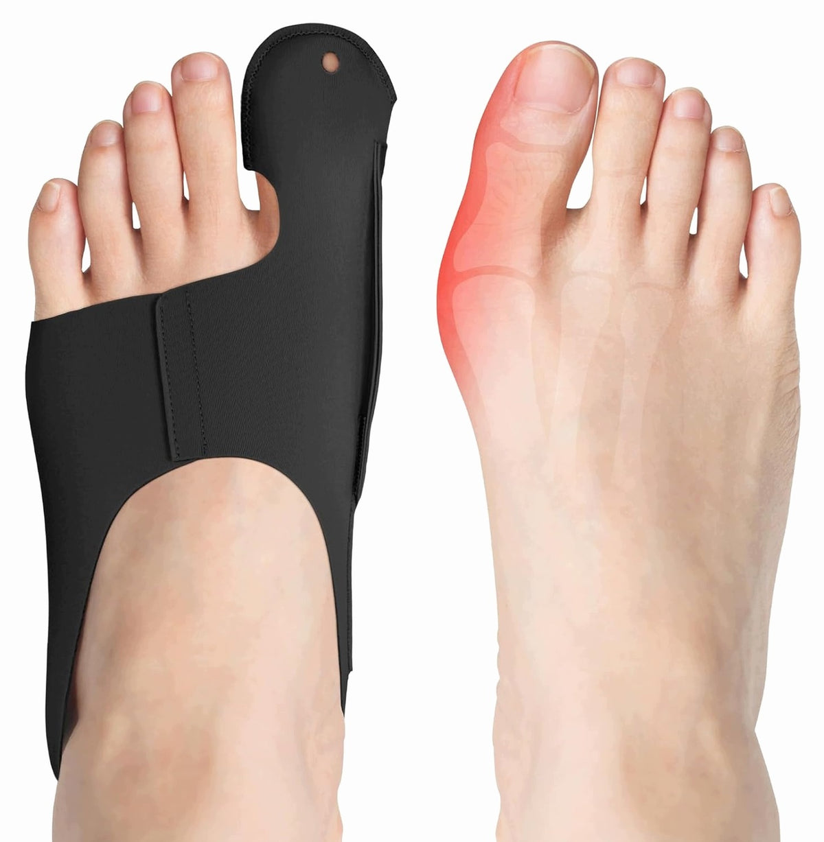 TOE CORRECTION BAND HALLUKSY SOFT BLACK BREATHABLE M