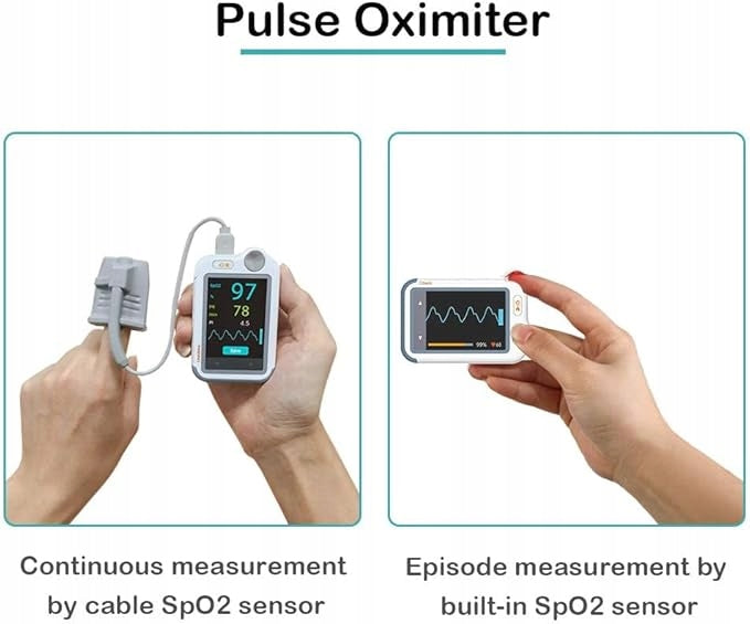 Viatom Checkme Lite pulse oximeter white ECG and SpO2 Medical device no