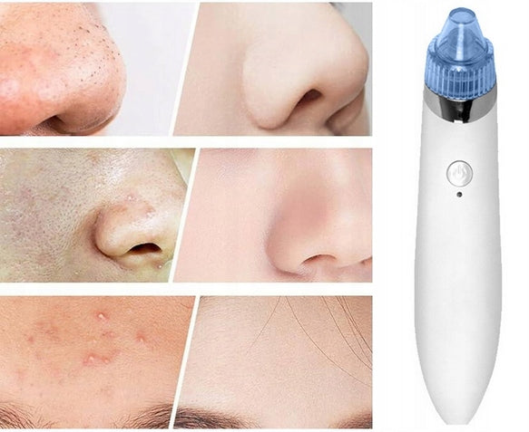 BLACKHEAD REMOVAL DEVICE NOSE SKIN CARE /2 Manufacturer code URZĄDZENIE DO ZASKÓRNIKÓW