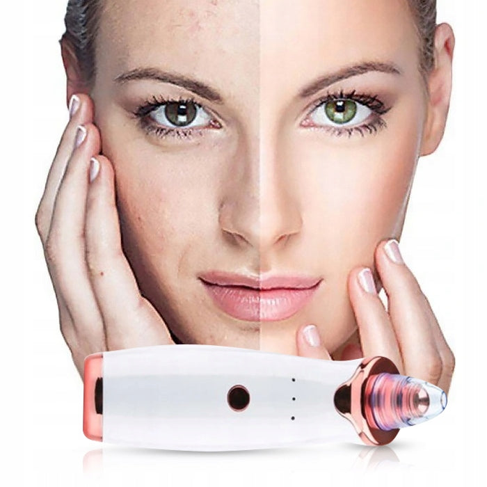 BLACKHEAD VACUUM CLEANER 12IN1 MICRODERMB+MASSAGER SET BLACKHEAD VACUUM CLEANER+ MASSAGER EAN (GTIN) 5900000030630
