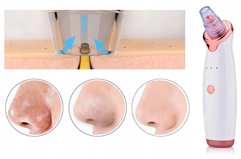 BLACKHEAD VACUUM CLEANER MICRODERMABRASION EAN (GTIN) 5903772142204