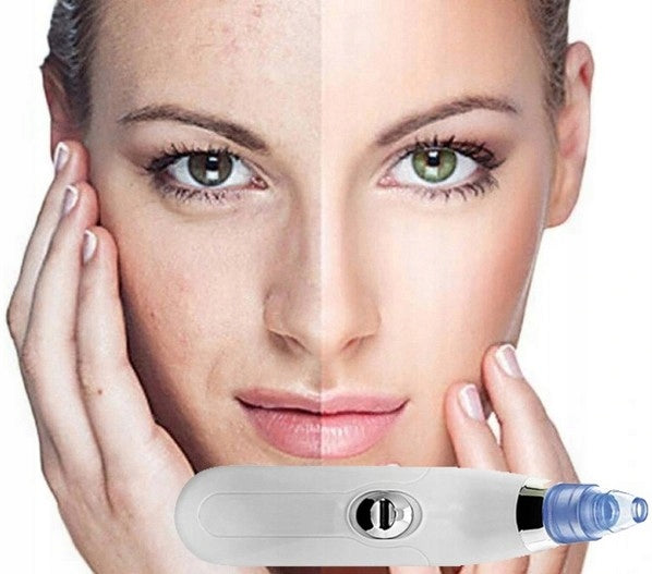 BLACKHEAD VACUUM CLEANER MICRODERMABRASION KUGO HOME Medical device no