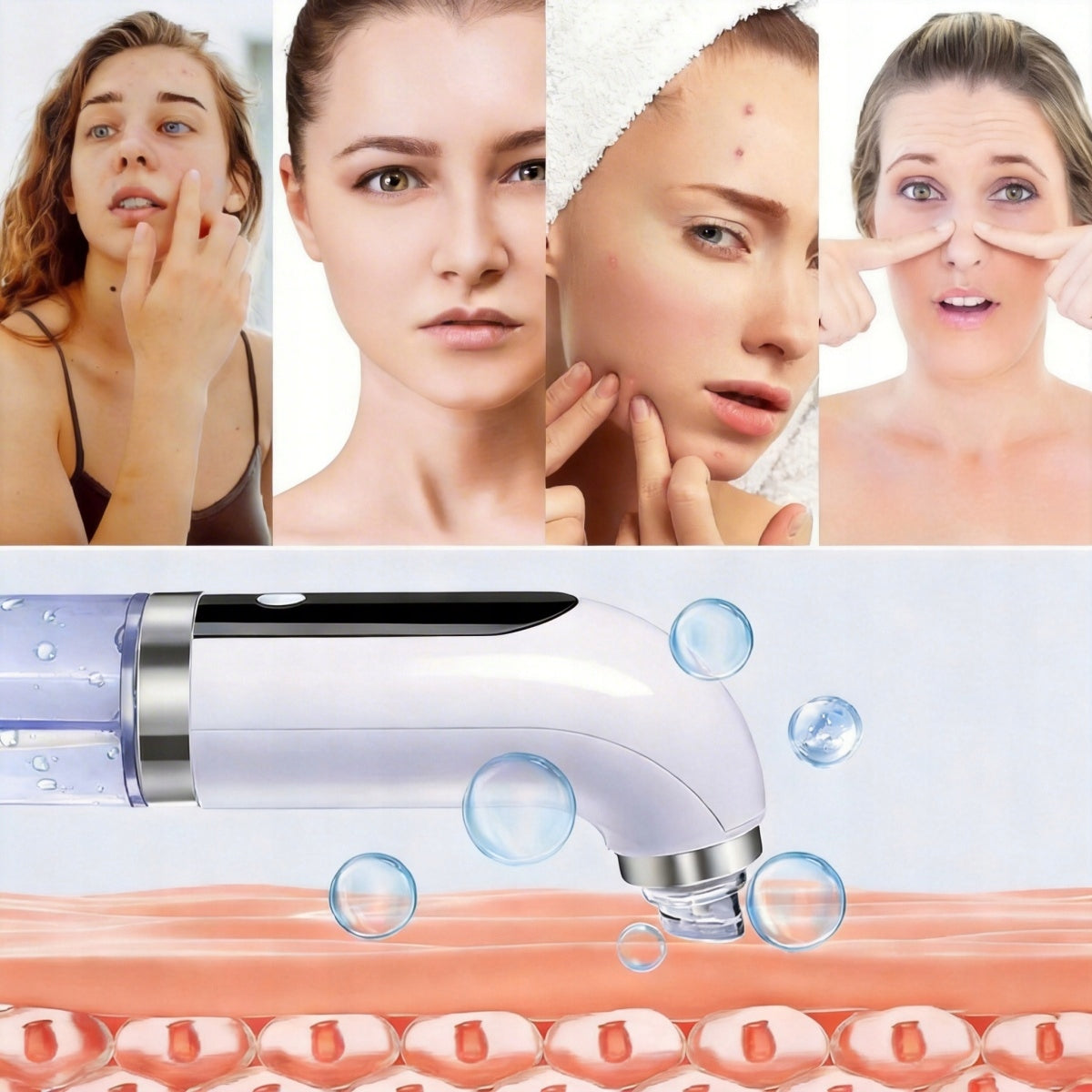 BLACKHEAD VACUUM CLEANER hydrabrasion FOR CLEANING PORES 6IN1 Brand no brand