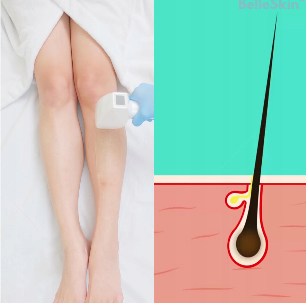 Belleskin pink laser epilator with IPL technology and cooling Brand no brand