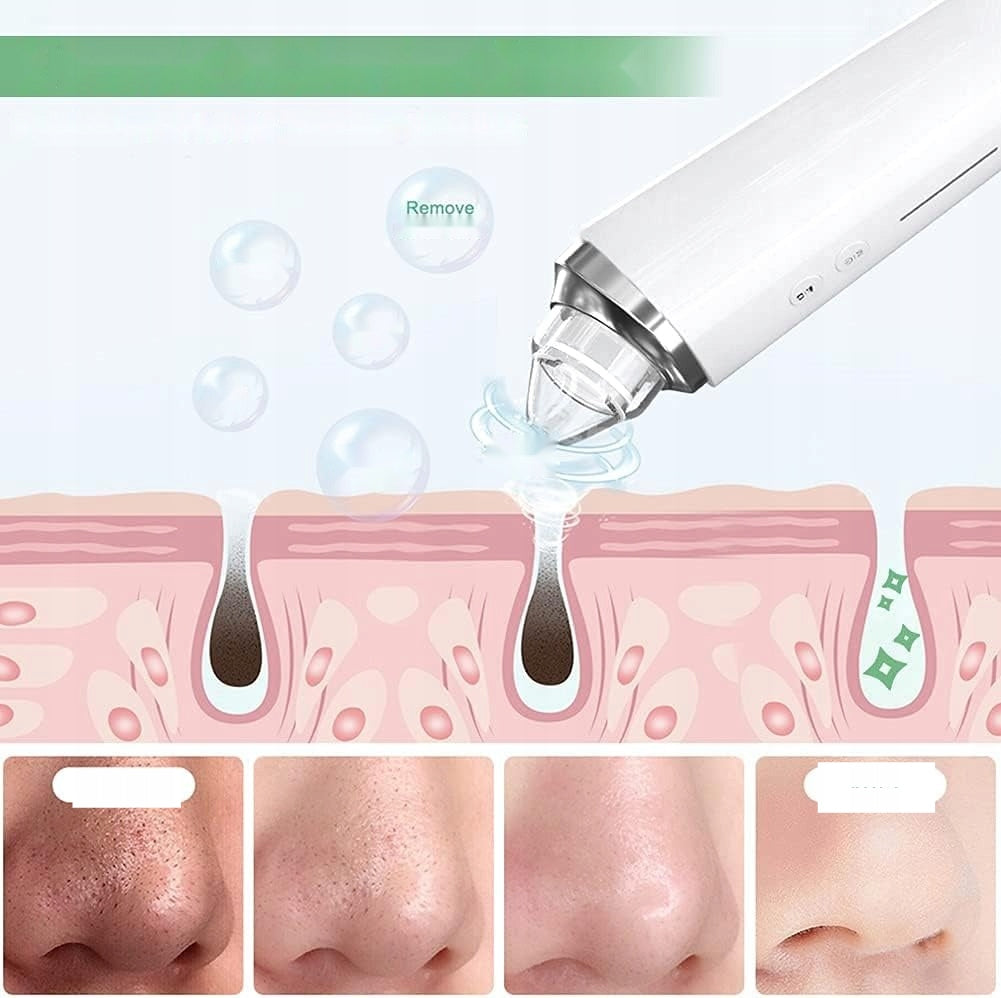 Blackhead Device HD Camera USB 5 Tips USB Pore Cleaner Packaging status original