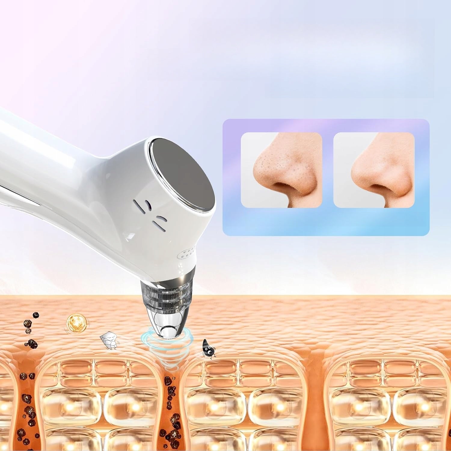 Blackhead Vacuum Cleaner Hydrabrasion Pore Cleaning 5 Tips USB LED Medical device no