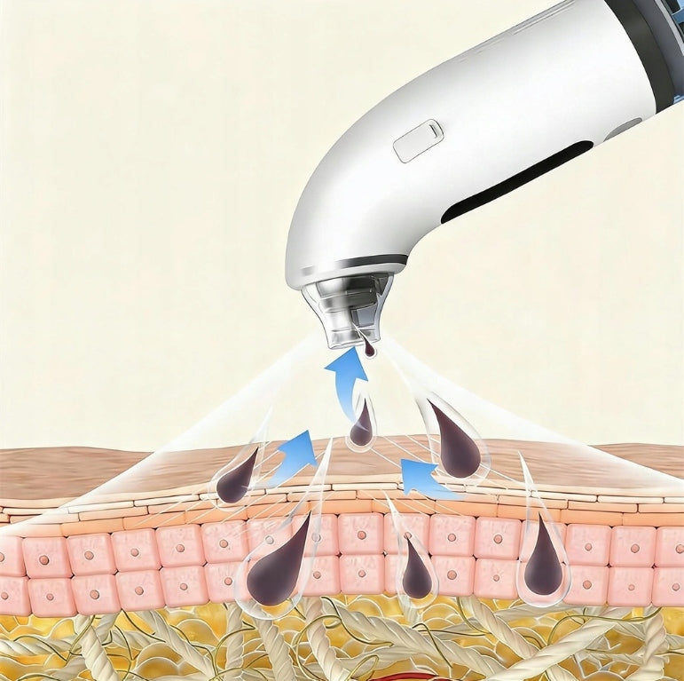 Blackhead vacuum cleaner blackheads and acne Power supply rechargeable battery