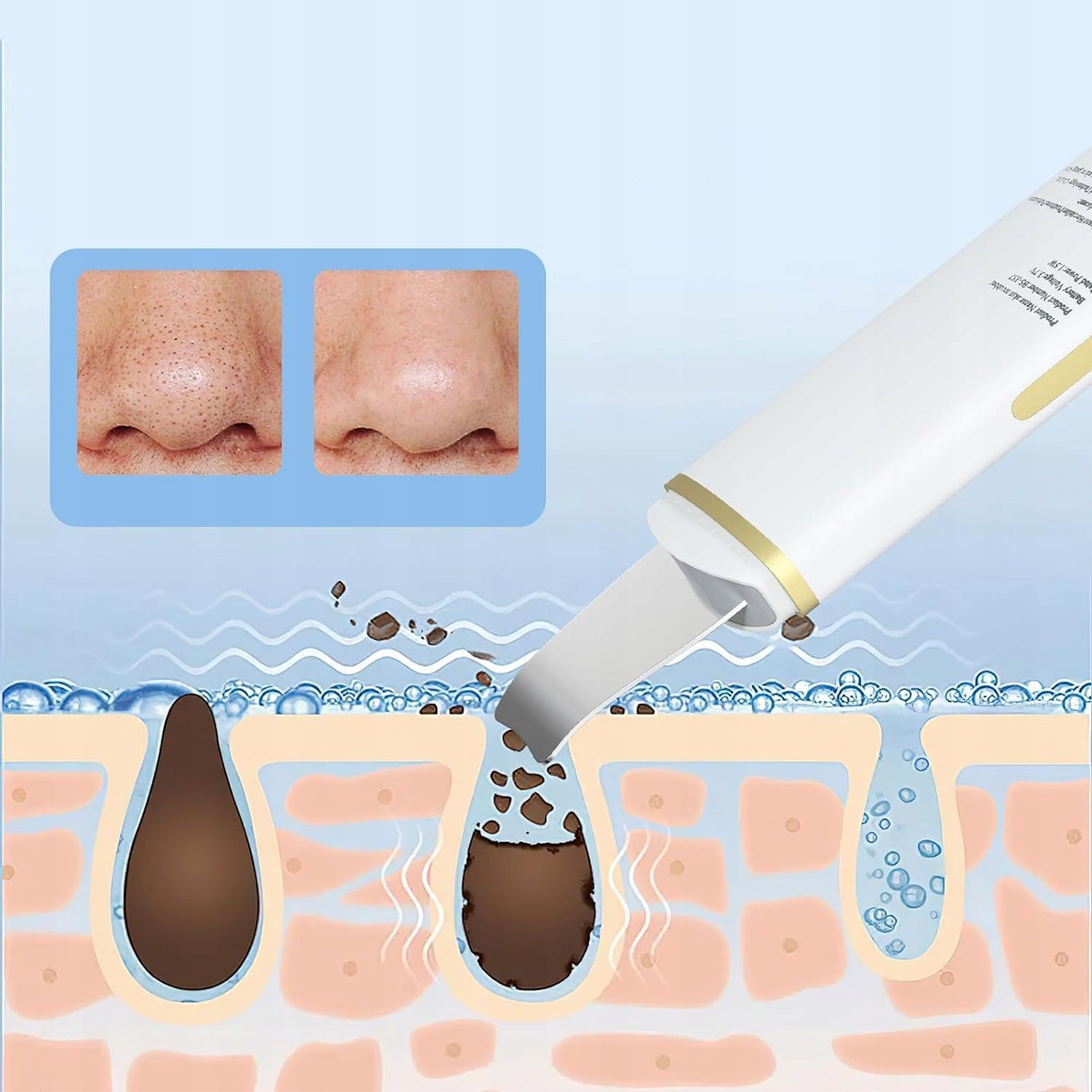 Cavitation peeling 4in1 FUNCTIONS regulation SONOPHORESIS IONTOPHORESIS1.5W Power supply battery