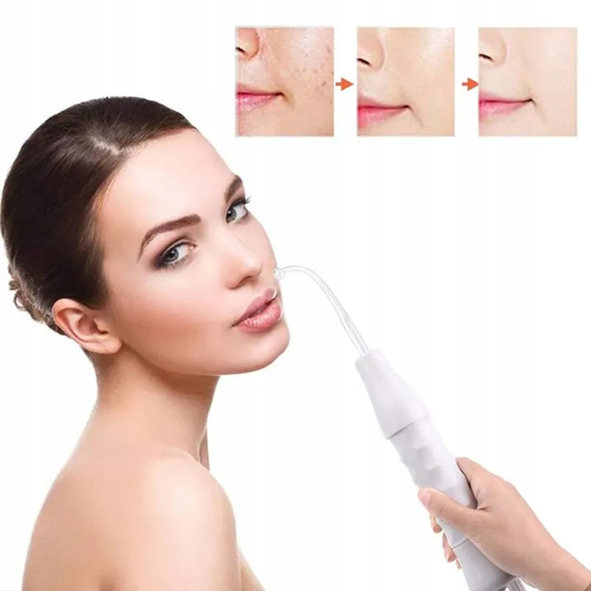 DARSONVAL DERMA WAND 4 PELLETS ELECTRODE CARE FOR BODY HAIR FACE Brand no brand