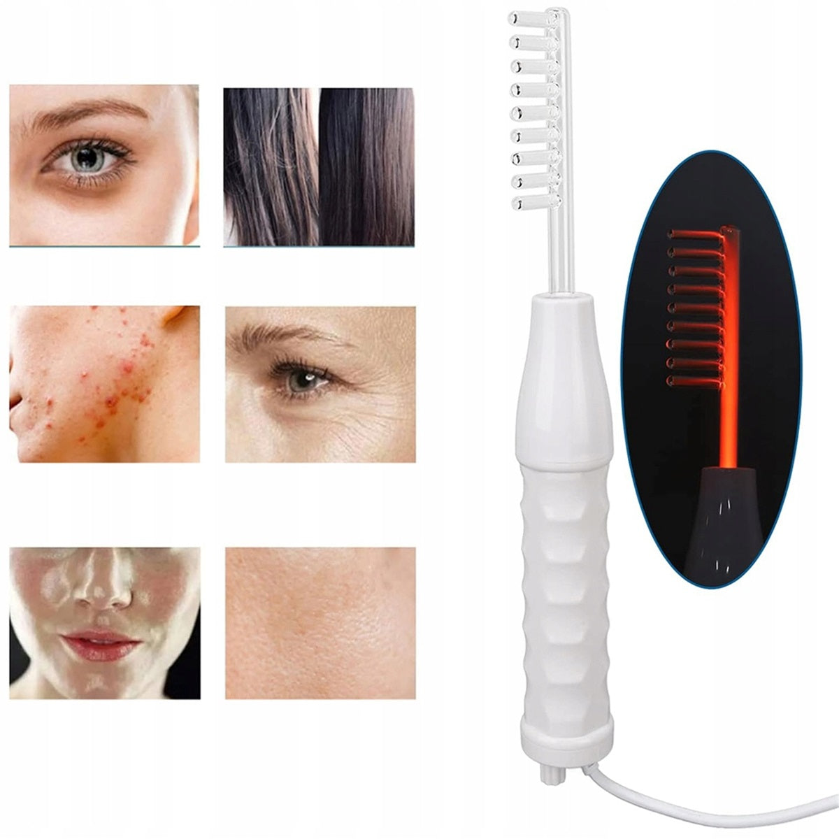DARSONVAL derma wand darsonval 4 electrodes 10 W Brand Bedee
