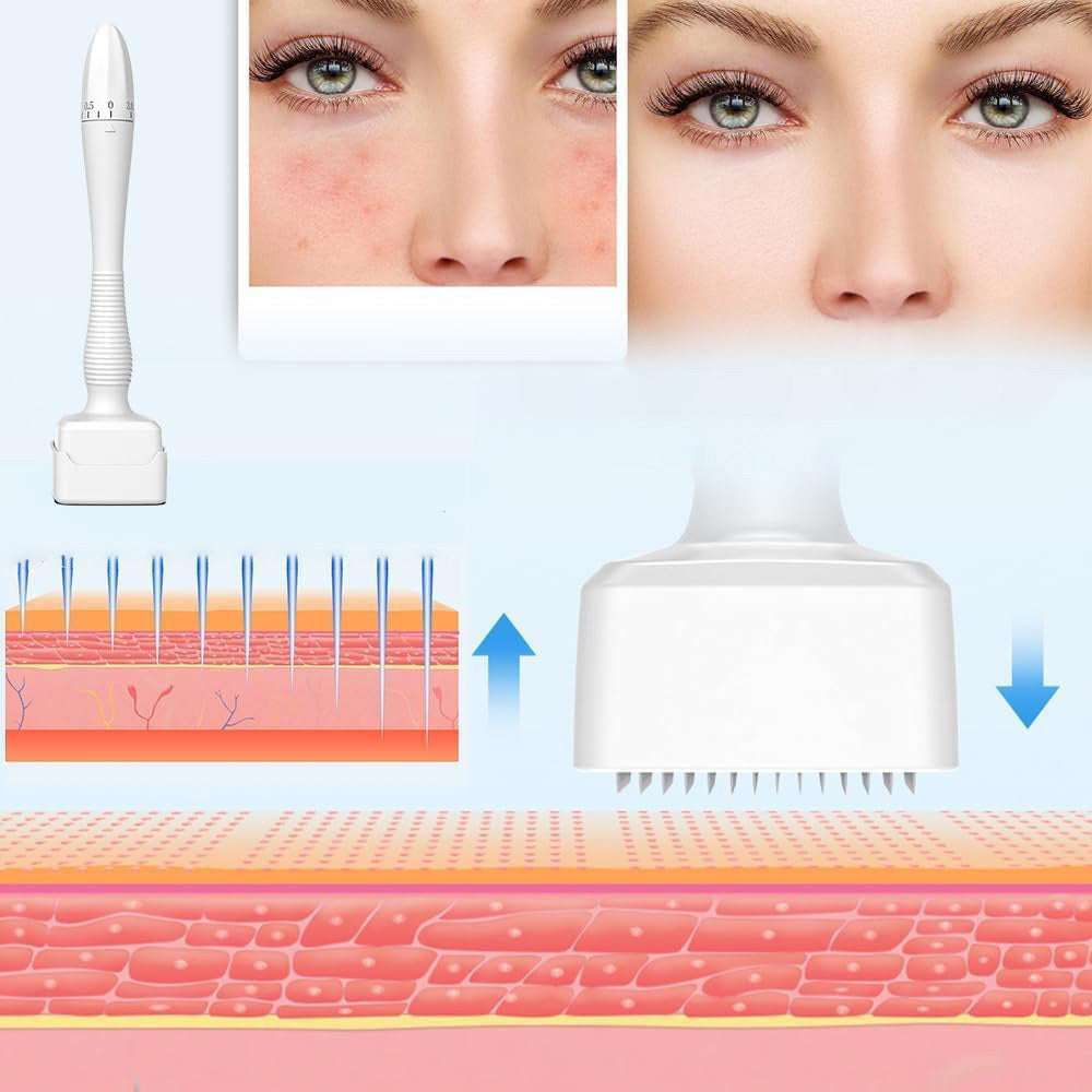 DERMA STAMP with adjustable needle length Batteries included no