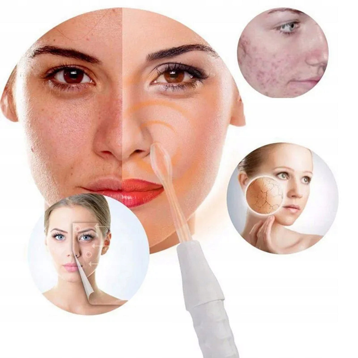 Darsonval Professional Cosmetic Device for Skin Care Hard-er Packaging status original