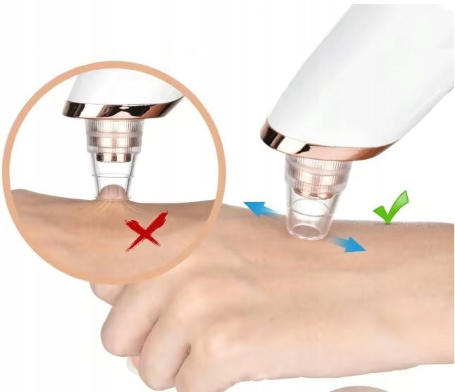 ELECTRIC DEVICE VACUUM CLEANER FOR BLACKHEADS PIMPLES BLACKHEADS Brand no brand