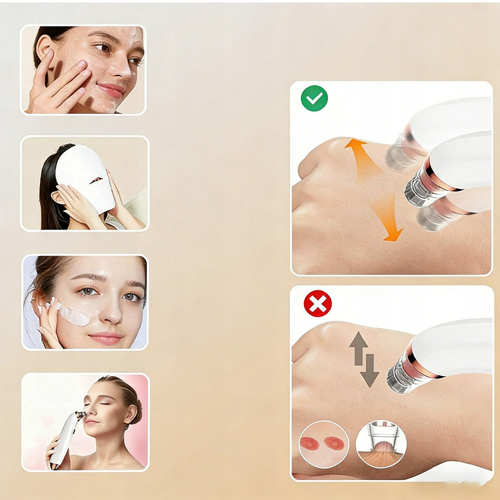 ELECTRIC FACIAL PORE PURIFIER DEVICE 6 SUCTION HEADS, PORTABLE Brand no brand
