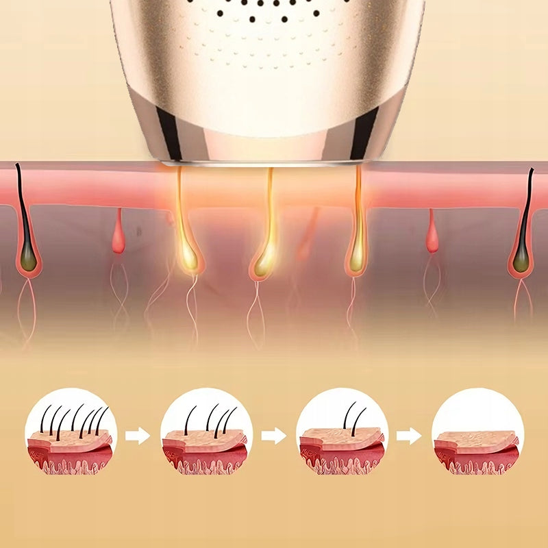 Epilator Laser Epilator IPL Body Care Quartz Lamp Ice Cool 9 Levels Packaging status original