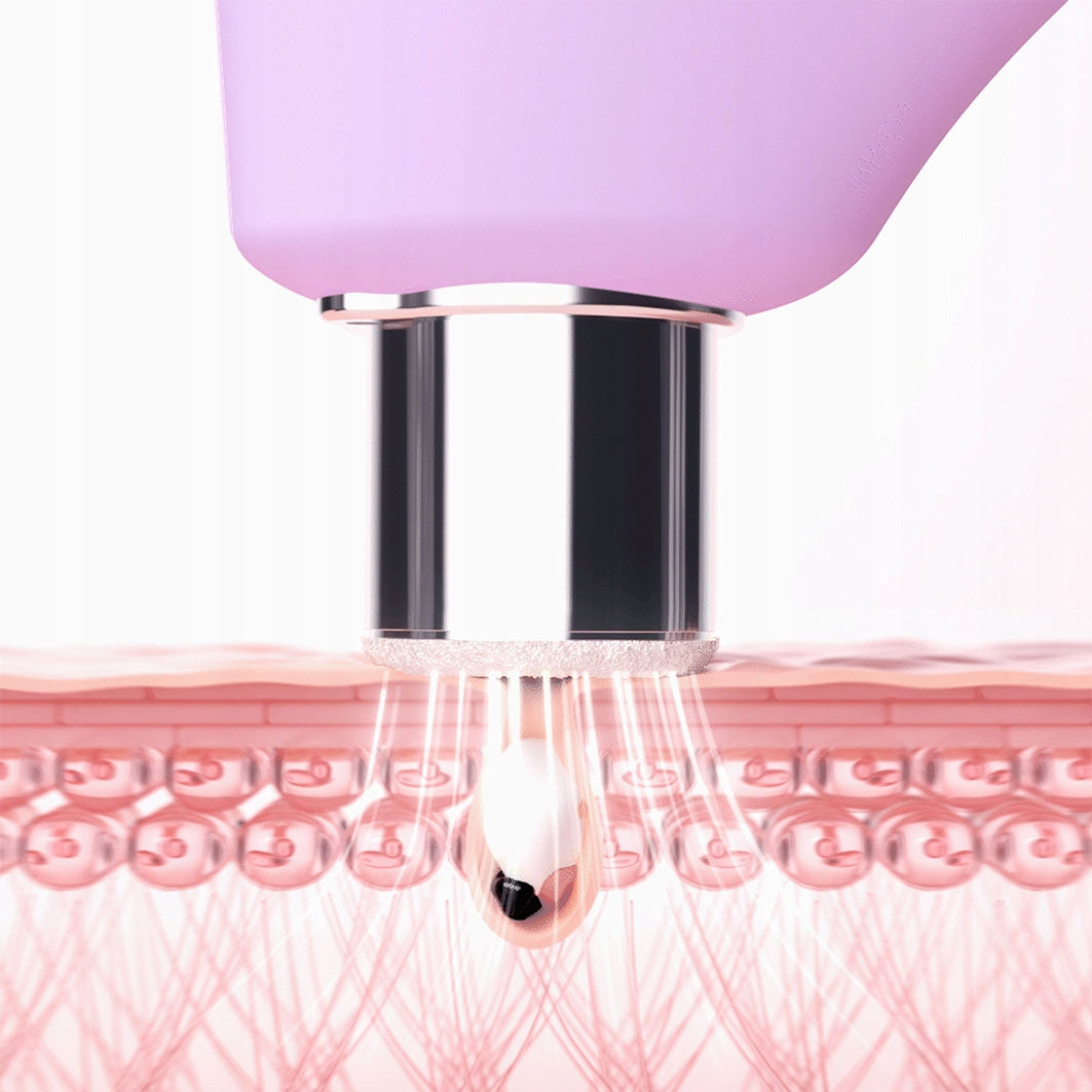 FOREO KIWI derma Diamond microdermabrasion device Packaging status original