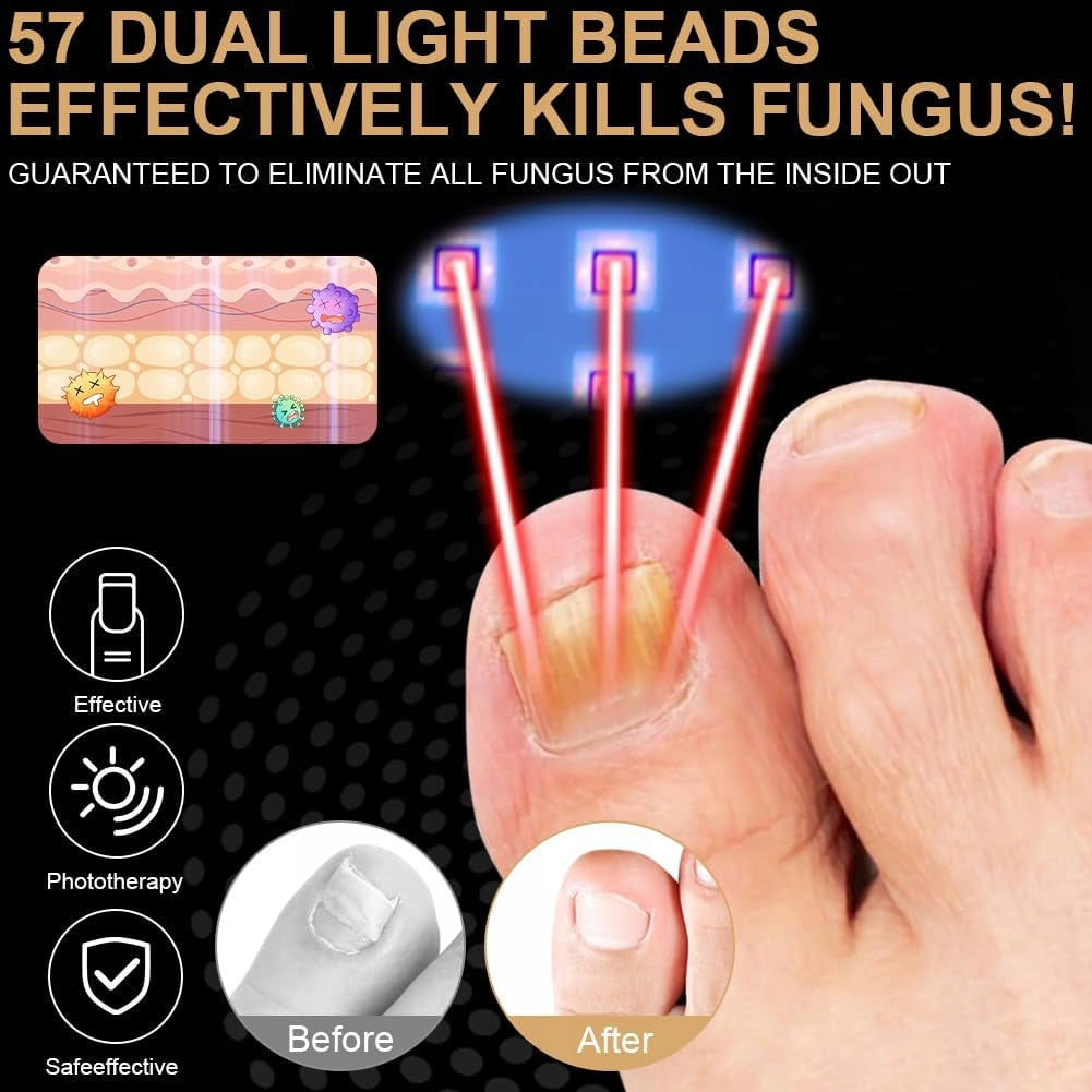 LASER DEVICE FOR REMOVING NAIL FUNGUS 365+405NM UV Color transparent
