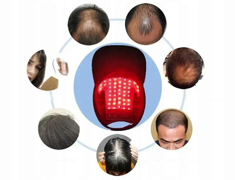 LED Hair Cap Red Light Therapy 660nm 850nm Support. Medical device no