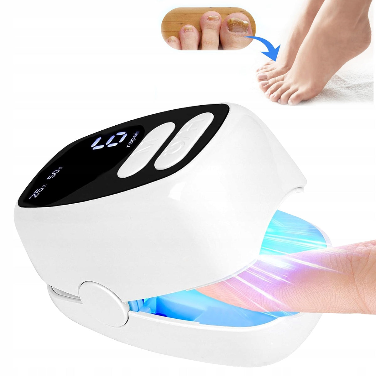 Laser device for the treatment of ringworm | Hands and Feet