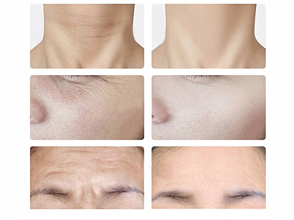 MASSAGER FOR FIRMING THE NECK AND FACE EMS LIFTING THE CHIN FIRMS EMS Manufacturer code lifting 3w1